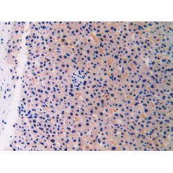 Breast Cancer Susceptibility Protein 1 (BRCA1) Antibody