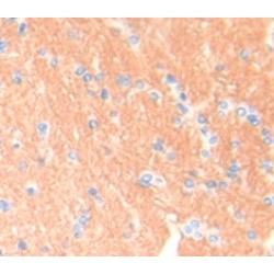 Breast Cancer Susceptibility Protein 1 (BRCA1) Antibody