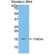Western blot analysis of the recombinant protein.