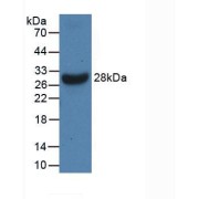 Western blot analysis of recombinant Human ERK2.