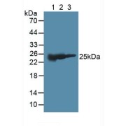 Western blot analysis of (1) Mouse Liver Tissue, (2) Porcine Liver Tissue and (3) Rat Brain Tissue.