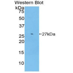 Glutathione S-Transferase Mu 2 (GSTM2) Antibody