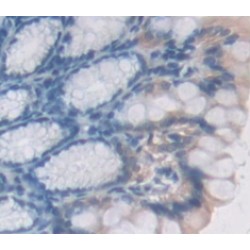 Glutathione S-Transferase Mu 2 (GSTM2) Antibody