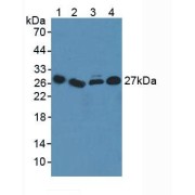 Western blot analysis of (1) Human Serum, (2) Human Liver Tissue, (3) Human Lung Tissue and (4) Human Jurkat Cells.