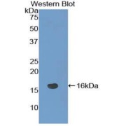 Western blot analysis of recombinant Mouse NRARP.