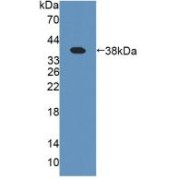 Western blot analysis of recombinant Human PIIINP.