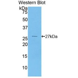 Pyruvate Dehydrogenase Kinase Isozyme 1 (PDK1) Antibody