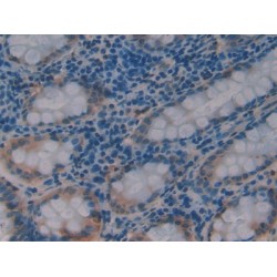 Pyruvate Dehydrogenase Kinase Isozyme 1 (PDK1) Antibody