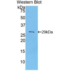 Pyruvate Dehydrogenase Kinase Isozyme 2 (PDK2) Antibody
