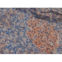Pyruvate Dehydrogenase Kinase Isozyme 2 (PDK2) Antibody