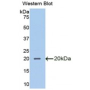 Western blot analysis of recombinant Mouse SLPI.