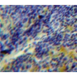 Serum/Glucocorticoid Regulated Kinase 3 (SGK3) Antibody
