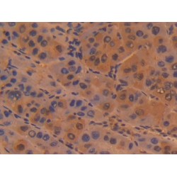 Sialic Acid Binding Ig Like Lectin 1 (SIGLEC1) Antibody