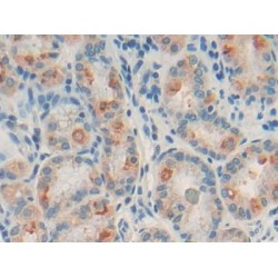Sialic Acid Binding Ig Like Lectin 2 (SIGLEC2) Antibody