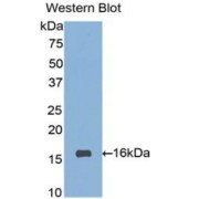 abx104097