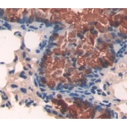 Apoptotic Peptidase Activating Factor 1 (APAF1) Antibody
