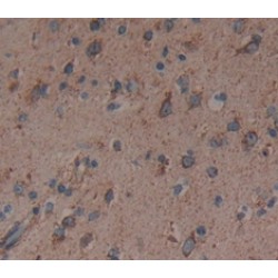 Granulocyte Colony-Stimulating Factor (CSF3) Antibody