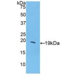 Granulocyte Colony-Stimulating Factor (CSF3) Antibody