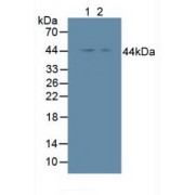Western blot analysis of (1) Human HeLa cells and (2) Human A375 Cells.