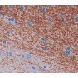 Inhibitory Subunit of NF Kappa B Epsilon (IkBe) Antibody