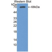 Western blot analysis of recombinant Human LSR Protein.