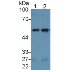 Lipolysis Stimulated Lipoprotein Receptor (LSR) Antibody