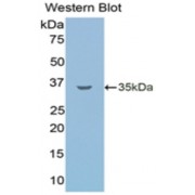 Western blot analysis of recombinant Human LSR Protein.