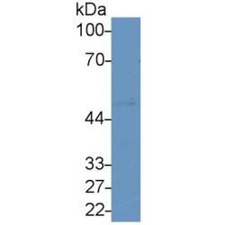 Lipolysis Stimulated Lipoprotein Receptor (LSR) Antibody