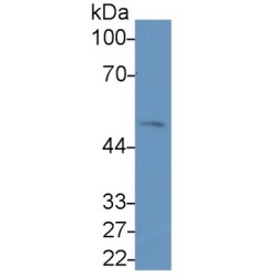 Lipolysis Stimulated Lipoprotein Receptor (LSR) Antibody