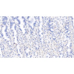 Lipolysis Stimulated Lipoprotein Receptor (LSR) Antibody