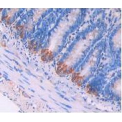 Lysosomal Associated Membrane Protein 2 (LAMP2) Antibody
