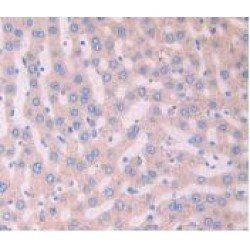 Lysosomal Associated Membrane Protein 2 (LAMP2) Antibody
