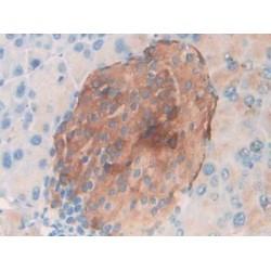 C-C Motif Chemokine 20 / MIP3A (CCL20) Antibody