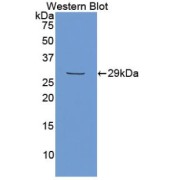 Western blot analysis of the recombinant protein.