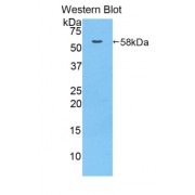 Western blot analysis of recombinant Human MACC1 (with N-terminal His and GST tags).