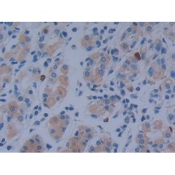 Metastasis Associated In Colon Cancer 1 (MACC1) Antibody