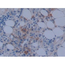 Metastasis Associated In Colon Cancer 1 (MACC1) Antibody