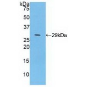 Western blot analysis of recombinant Human MAT2a.