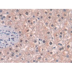 Methionine Adenosyltransferase II Alpha (MAT2a) Antibody