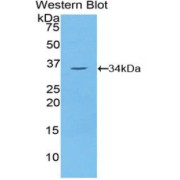 Western blot analysis of the recombinant protein.