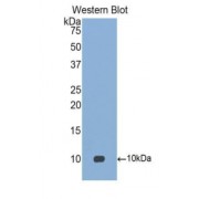 Western blot analysis of recombinant Human PARC.