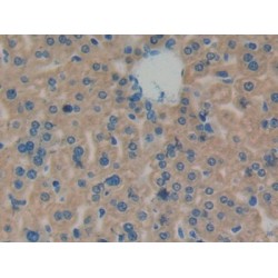 Carnitine Palmitoyltransferase 1A, Liver (CPT1A) Antibody