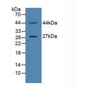 abx104147