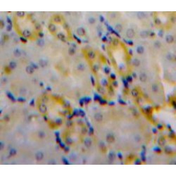 Chloride Intracellular Channel Protein 4 (CLIC4) Antibody
