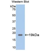 Western blot analysis of the recombinant protein.