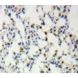 Chloride Intracellular Channel Protein 4 (CLIC4) Antibody