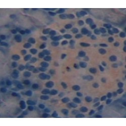 Early Activation Antigen CD69 (CD69) Antibody