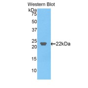Western blot analysis of the recombinant protein.