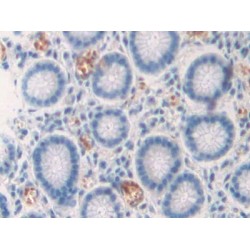 C-Type Lectin Domain Family 4, Member M (CLEC4M) Antibody