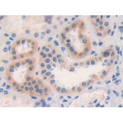 C-Type Lectin Domain Family 4, Member M (CLEC4M) Antibody